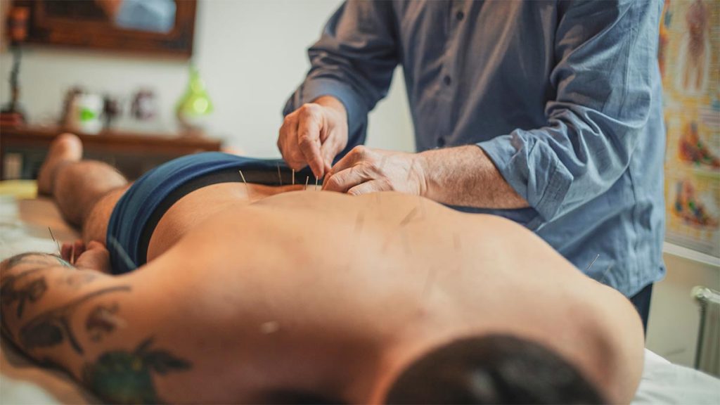 Patient receiving acupuncture